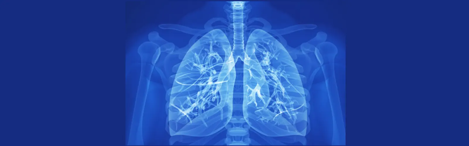 What Is The Role Of CT Chest 3D In Respiratory Health?